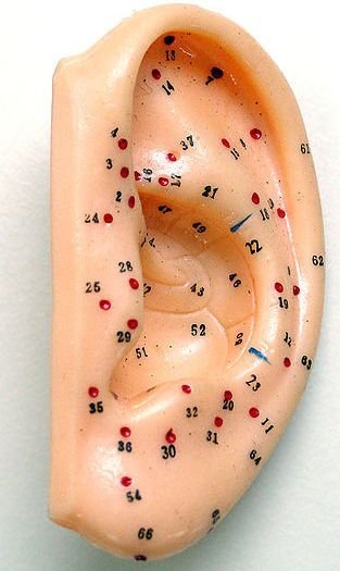 auriculoterapia 2